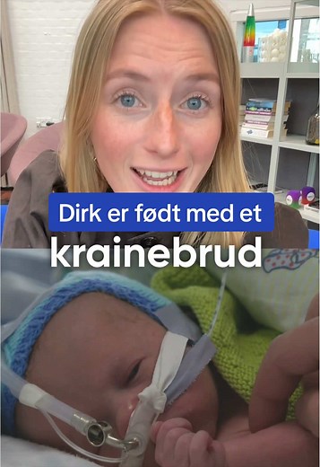 Brækkede knogler styrer ikke Dirks liv