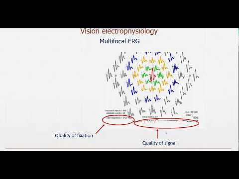 MonPackONE -2- Vision electrophysiology Multifocal ERG