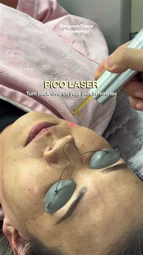 Hollywood Laser Facial in Minutes ✨ | Pico Laser Skin Reset Korea