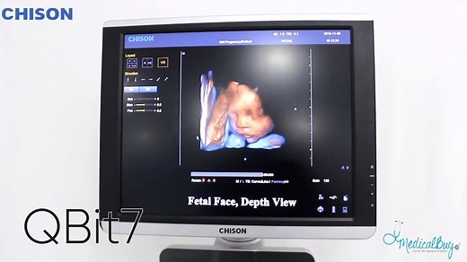 ‼️PLANES DE FINANCIAMIENTO‼️ Adquiere un ultrasonido de gabinete QBIT7 de #Chison y realiza estudios con tecnologías de excelente nivel como: ✅ 4D, 5D, HD VIRTUAL LIVE ✅ Elastografía, Super needle, Color Doppler ✅ Q-image, X-contrast, SRA, THI ✅ Imagen panorámica, dual live, triplex, cuadplex, duplex 💵PLANES DE FINANCIAMIENTO 💳PAGOS CON TARJETA 📦ENTREGA INMEDIATA* ✈️ENVÍOS A TODA LA REPÚBLICA MEXICANA ¡Cotiza Ahora! ☎️ 01 .800 .890 .51 .74 (55) 58 61 89 00 - (55) 58 61 89 01 (55) 58 61 89 19