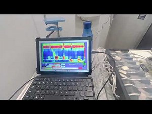 Esophageal manometry for difficulty in swallowing