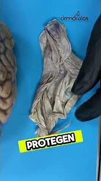 Las meninges; las capas que protegen al cerebro #drmorelos #anatomy #medico