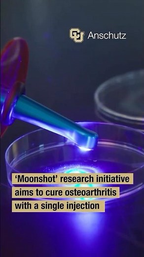 CU-Led Project Targets Osteoarthritis Reversal