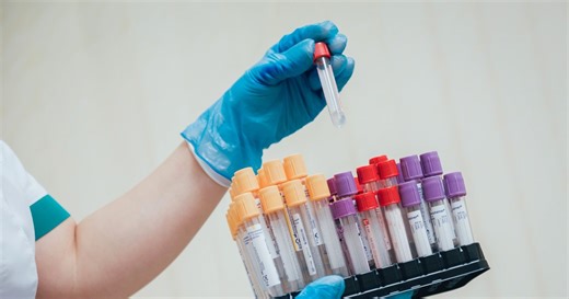 Darmowe badania nawet dla 30 mln Polaków. NFZ zaprasza od maja