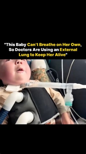Wealth | Finance | Tech on Instagram: "This newborn’s lungs were too weak to work on their own, so doctors placed her on ECMO, a machine that acts as an external lung. It oxygenates her blood, removes carbon dioxide, and keeps her alive while her tiny body fights to get stronger. Every second on ECMO is delicate, but she’s slowly showing signs of improvement thanks to incredible medical care. Via:Oumse Dia six/Facebook #newborn #ecmo #lungsissue #emotinal #didyouknow #wealthywishdom"