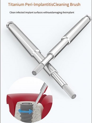 How to Use a Titanium Brush for Peri-Implantitis | Implant Cleaning Without Damage