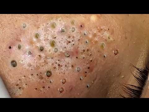 𝑺𝒐𝒐𝒕𝒉𝒊𝒏𝒈 𝑭𝒂𝒄𝒊𝒂𝒍 𝑻𝒓𝒆𝒂𝒕𝒎𝒆𝒏𝒕 𝒇𝒐𝒓 𝑺𝒕𝒓𝒆𝒔𝒔 𝑹𝒆𝒍𝒊𝒆𝒇 | 𝑫𝒆𝒆𝒑 𝑪𝒍𝒆𝒂𝒏𝒊𝒏𝒈 & 𝑪𝒂𝒍𝒎𝒊𝒏𝒈 𝑴𝒂𝒔𝒔𝒂𝒈𝒆 𝒂𝒕 𝑳𝒖𝒙𝒖𝒓𝒚 𝑺𝒑𝒂 #887530