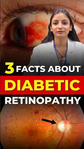 3 Shocking Facts About Diabetic Retinopathy