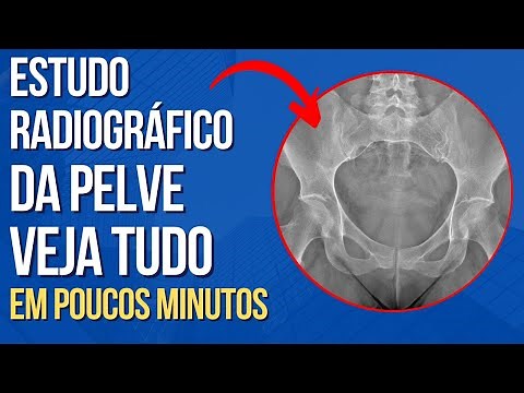 Radiographic anatomy of the pelvis