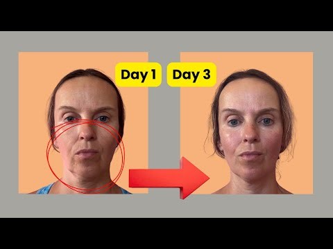 Face Self-Massage Routine | 9 Lifting Techniques for Visible Face Lift (Day 1–3)
