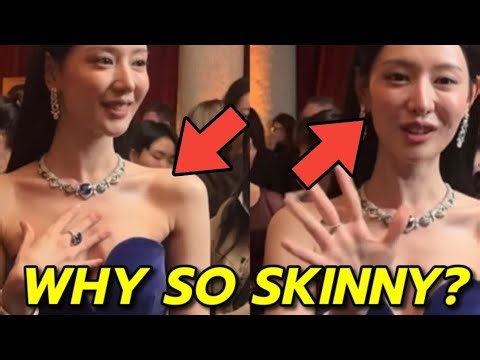 What’s going on with Kim Ji won increasingly thin condition?