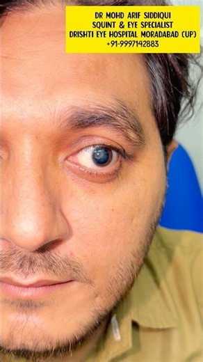 Traumatic Cataract Explained | How an Eye Injury Can Cause Cataract | Diagnosis, Treatment & Surgery