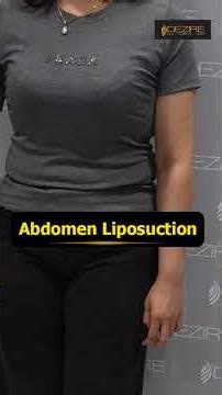 Abdomen Liposuction Feedback