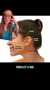 56K views · 649 reactions | Case Study 147 - Hemi-Facial Spasm...