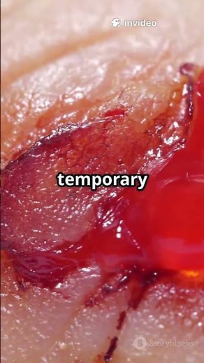 Hemostasis : A Life-Saving Biological Process!