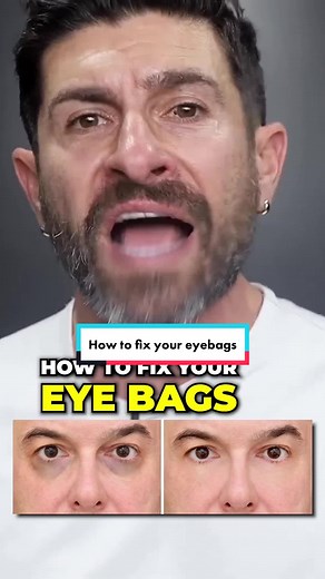 Effective Ways to Fix Your Eyebags Quickly