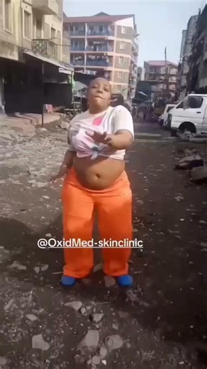 weight loss before and after transformation