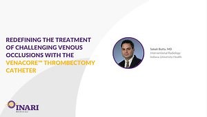 Redefining the Treatment of Challenging Venous Occlusions with the VenaCore™ Thrombectomy Catheter