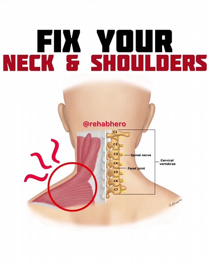 Effective Neck and Shoulder Mobility Exercises for Pain Relief