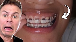 What’s Behind Those Pesky Dino Teeth?! 🦖🦷 #MindfulLiving #WinterGoals #snaggletooth #teeth #dentist #dentalfacts | TheBentistofficial