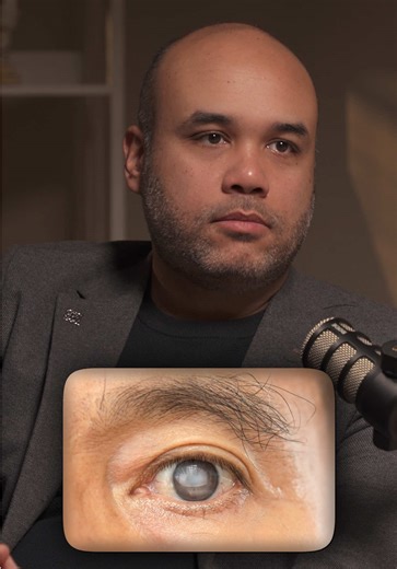 When to Remove Cataracts for Clearer Vision