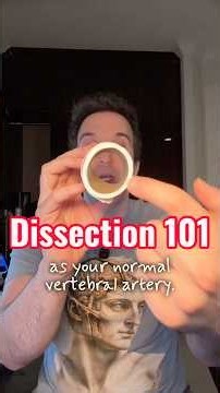 What’s a vertebral artery dissection?