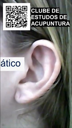 Studying the ear is difficult #acupuncture #auriculotherapy