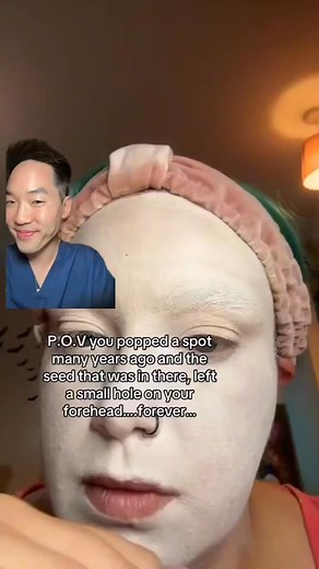 Acne #dermatologist #dermatology #drdavidkimderm #skincare #skincareroutine #skin #acne #acnescars | Dr David Kim