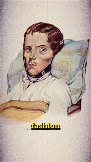 How Tuberculosis Secretly Shaped 1800s Fashion #historyfacts
