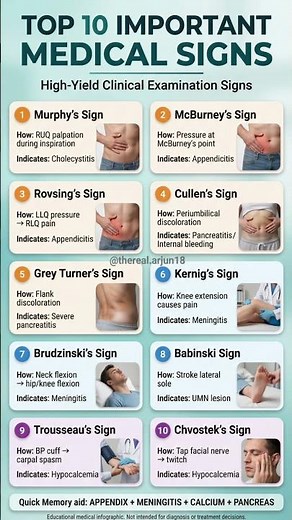 Top 10 Important Medical Signs | High-Yield Clinical Examination Guide