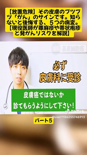 皮膚のブツブツが示すがんのサインとは