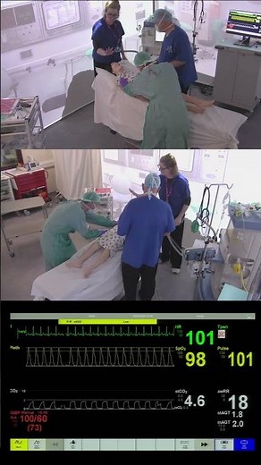 Paediatric Laryngospasm Simulation – Anaesthetics Emergency Scenario