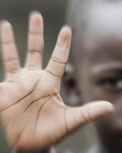 50K views · 79 reactions | In the fight against Malaria, many...