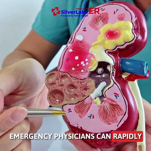Severe Flank Pain May Need Emergency Care