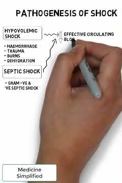 Pathogenesis of Shock || Pathology shorts || Medicine Simplified #shorts #medicine