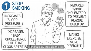 ⚠️ Around 43% of angina patients symptoms remain underrecognised. Angina is more than ❤️ heart pain! 📽️ Check out more about what is angina, common symptoms and how to live better with angina. Check out more about Angina 👉 https://bit.ly/3inOmhA #actnowonangina #anginaawarenessinitiative #useheart #angina #HeartRate #EveryBeatMatters | Servier