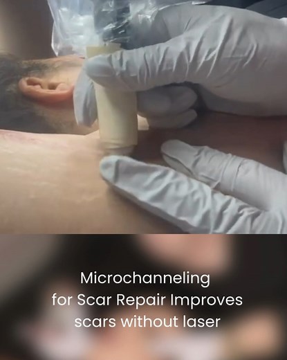 Before and after photos are great… but what you don’t see is the...