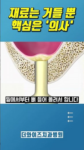 It is solely the 'doctor's manual dexterity' that determines the teeth you will use for a lifetim...