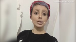 Meet the woman who had surgery 'to look like Angelina Jolie'