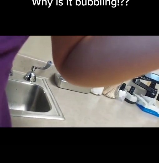 Understanding Bubbling Noises in Your Stomach