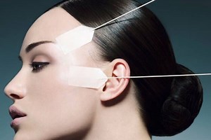 Hilos Tensores: Cómo actúan en la cara y qué resultados puedes esperar