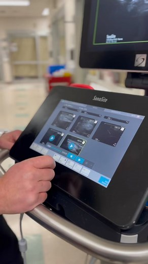 Here we are performing a superficial cervical plexus block. We use this block for surgeries in the lower head and neck. The superficial cervical plexus is a bundle of nerves that provides sensory innervation to the anterior and lateral neck, the tissues underneath and the platysma muscle. We find that for anterior cervical discectomy and fusion procedures this block helps patients to be more comfortable in the PACU. They have significantly less incisional pain and anterior muscle pain. They do s