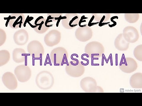 Target Cells (Codocytes) Erythrocytes (in Hemoglobin Lepore Baltimore Thalassemia) Blood Smear