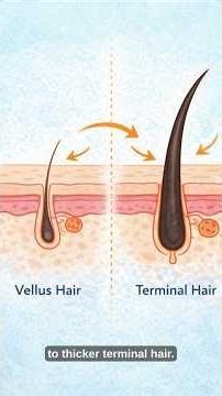 What Causes Changes in Body Hair Thickness?