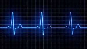 Video Shows Looping Animation Electrocardiogram Ecg Stock Footage Video (100% Royalty-free) 3522211969 | Shutterstock