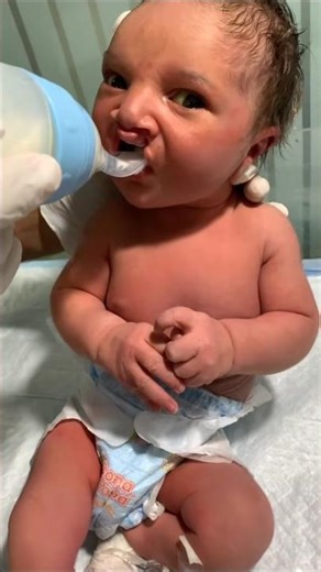 Cleft Lip Baby in NICU 💕💔 Still a Fighter🍼#trendingshorts #shortvideo #cutebaby #nicu #shorts