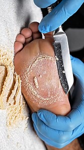 A clean and relaxing foot care process #footcare #pedicure #relaxing #oddlysatisfying #lifestyle Beautiful moments from a calm and carefully done foot care routine. A gentle, well-paced process that feels clean, simple, and relaxing to watch. Smooth movements, neat details, and a satisfying workflow designed for comfort and calm. ✨ Disclaimer: This video is shared for general viewing and relaxation purposes only. | FlakeAway Pro