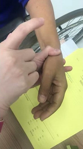 Inverted radial reflex