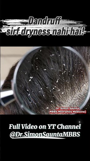 Why Dandruff Happens | Science Explained by Doctor #haircare #dandruffsolution #dandrufftreatment