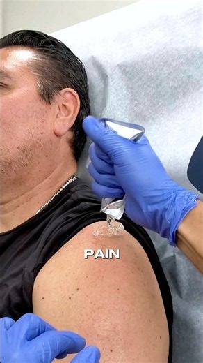 How to relieve shoulder pain? #painmanagement #health #painrelief #arthritis